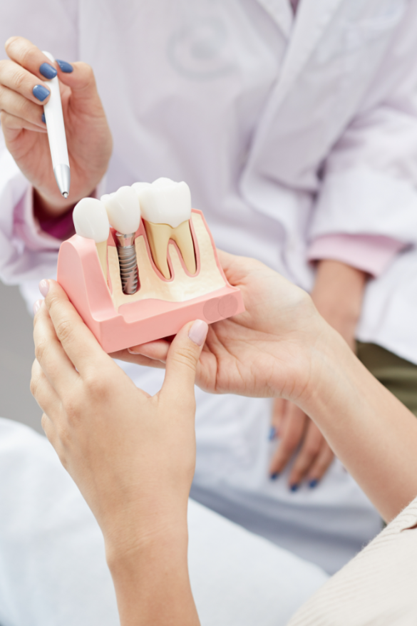 Dentist using a pen to explain a dental implant on a tooth model while a patient holds the model during a consultation.